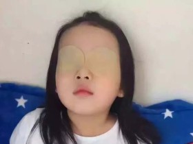 眼贴护眼的原理是什么,到底有没有科学依据?